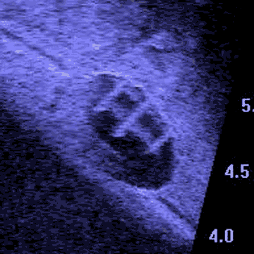 Grate of the Brummer